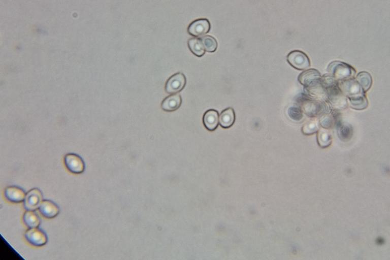 Spore di Leucocoprinus leucothite osservate al microscopio